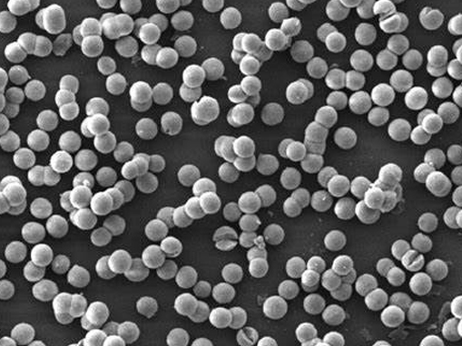 细说球形氧化镁在都热领域的突出表现